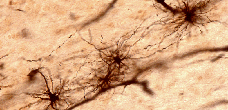 astrocytes brain health