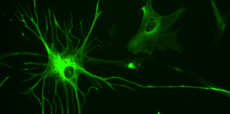 astrocytes role