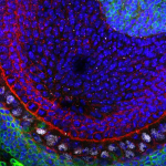 neural stem cells and epigenetics