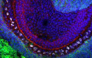neural stem cells and epigenetics