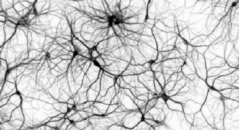 dark neuron affects brain function