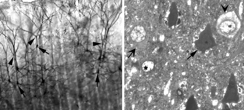 dark neuron detection