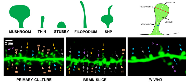 dendritic spines anatomy