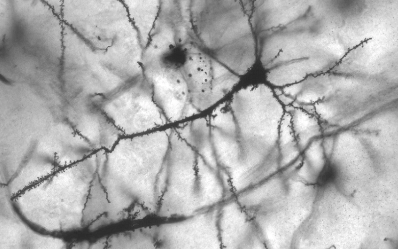 dendritic spines shape memory learning