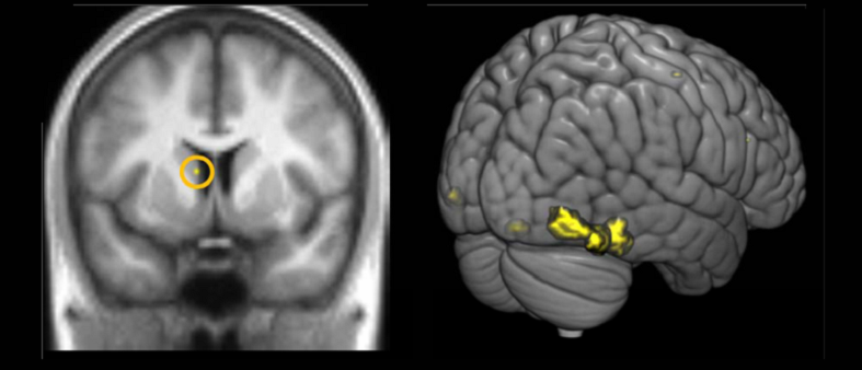 fusiform gyrus understanding