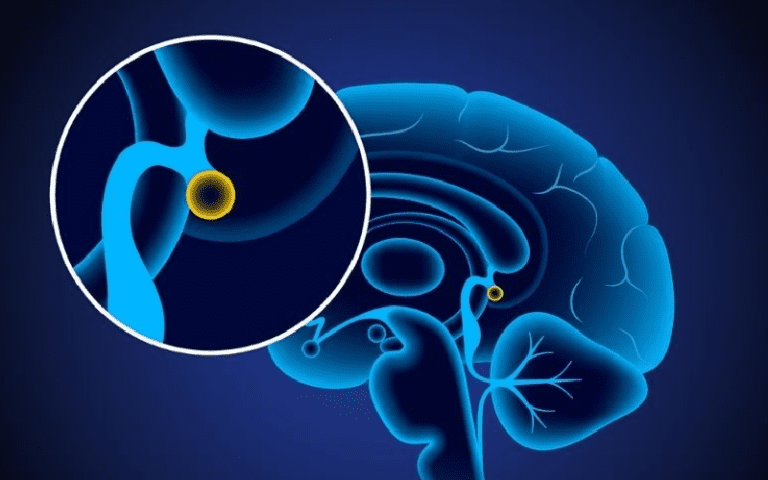 pineal gland melatonin sleep regulation