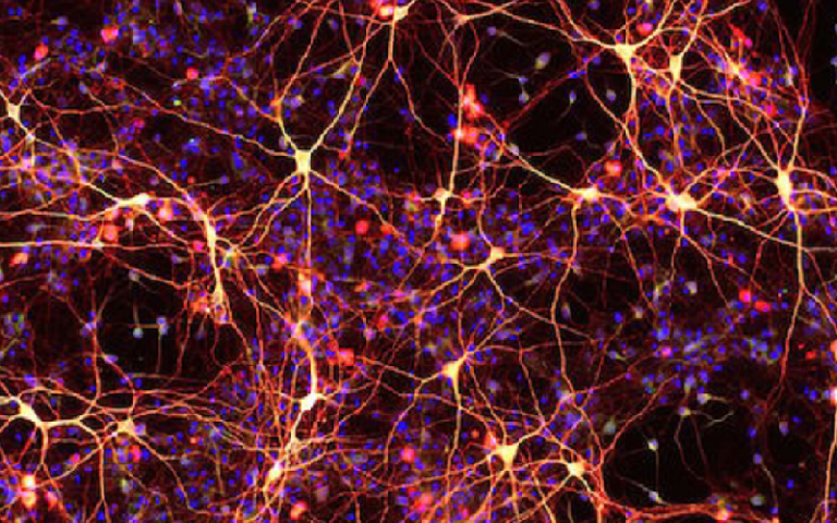 von economo neurons vens function