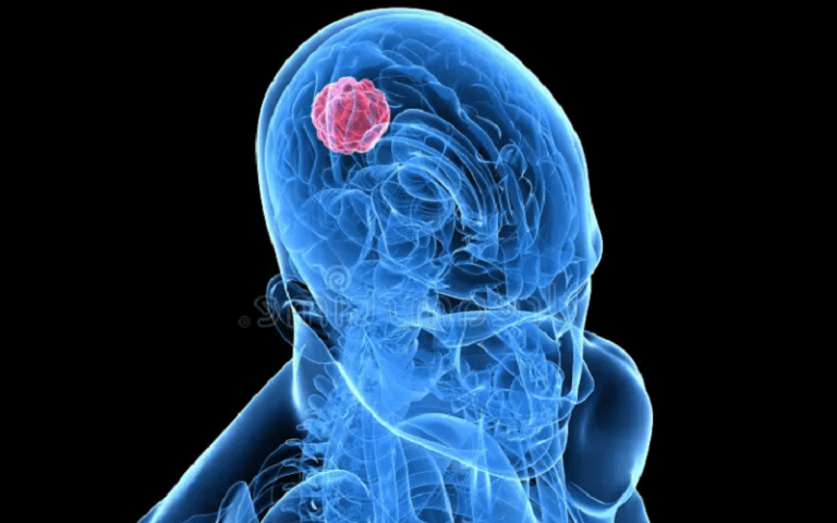 anterior commissure many functions and roles