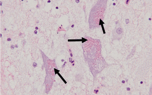 neuronal ceroid lipofuscinosis ncl