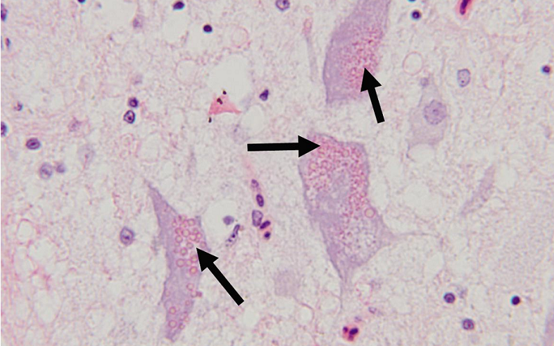 neuronal ceroid lipofuscinosis ncl