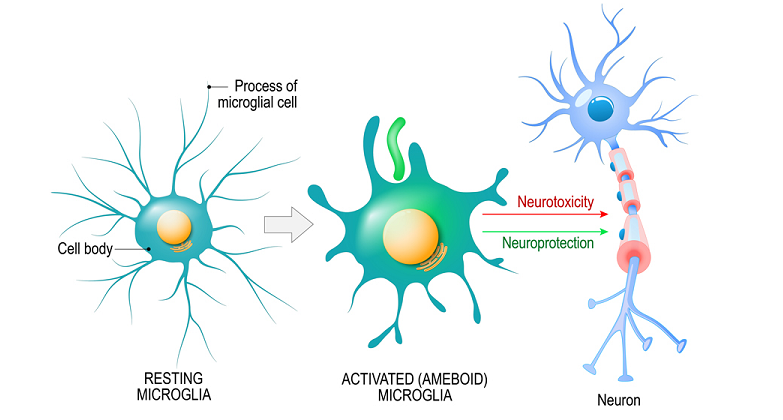 neuroprotection dietary strategies