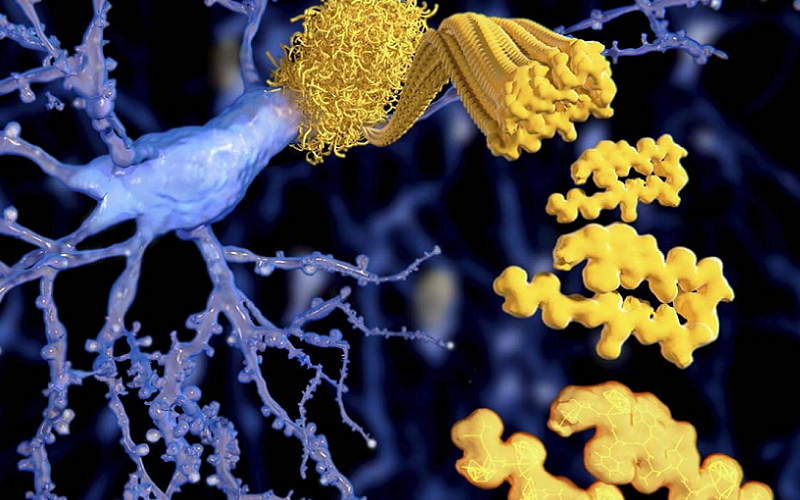 calcitonin gene related peptide migraine