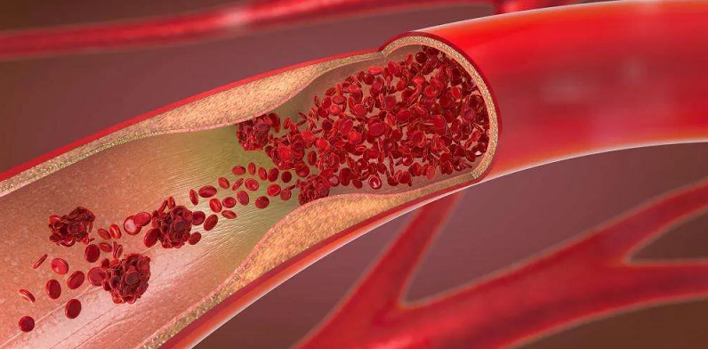 cerebral circulation impacts cognition