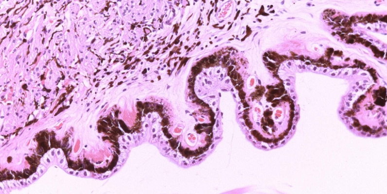 cerebrospinal fluid properties