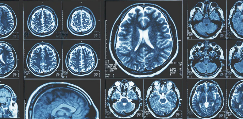 Journey Through the Brain: Understanding Our Cognitive Pathways - Very ...