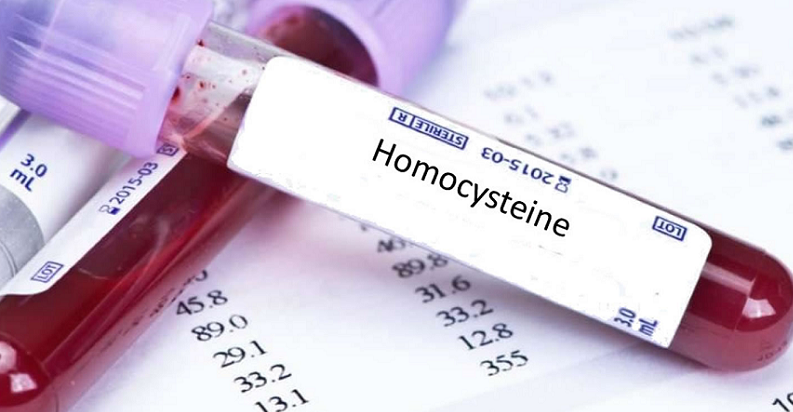 homocysteine metabolism brain