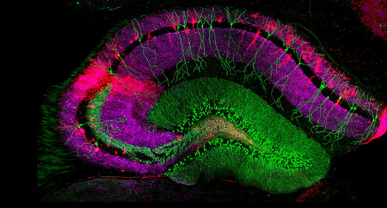 pnns and memory regulation