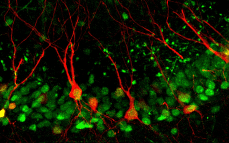 hippocampus role memory recall formation