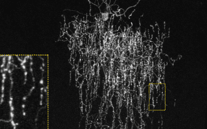 chandelier cells inhibitory neurons