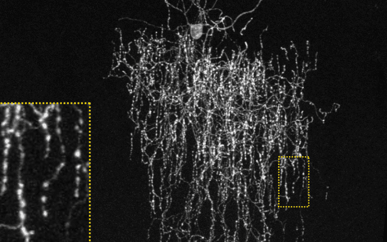 chandelier cells inhibitory neurons