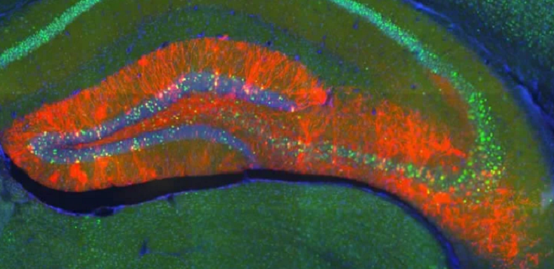 dentate gyrus neurogenesis