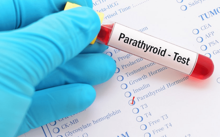 parathyroid hormone pth imbalance cognition