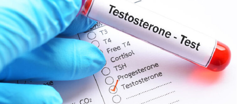 testosterone brain plasticity